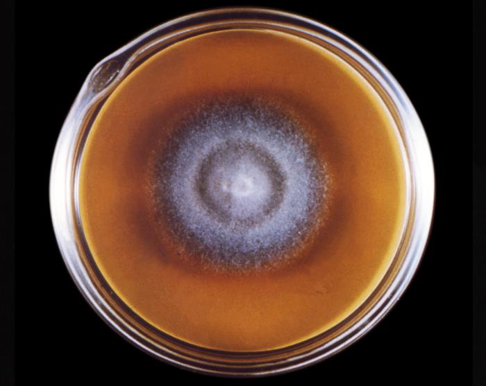 Madurella grisea. CDC Public Health Image Library (PHIL).