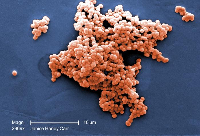 Streptococcus spp. CDC Public Health Image Library (PHIL).