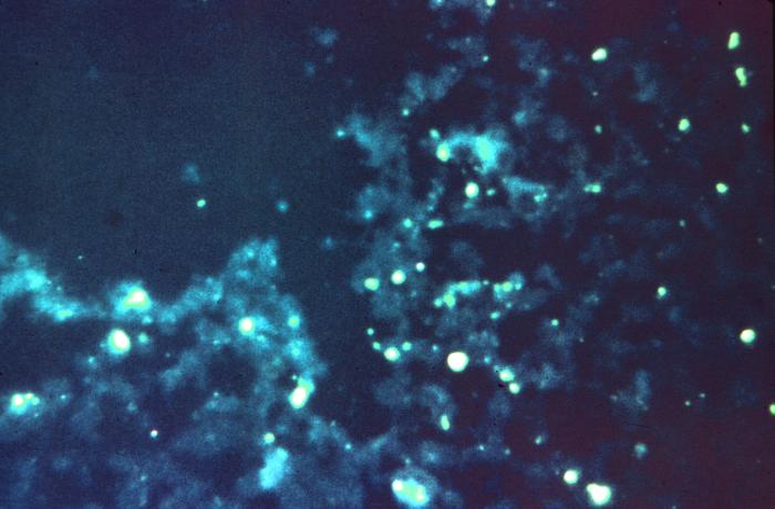 Virus de la rabia. CDC Public Health Image Library (PHIL). 