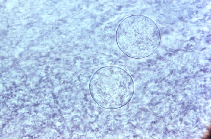 Esférulas de Coccidioides sp. CDC Public Health Image Library (PHIL).