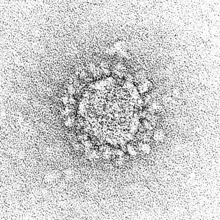 Virión de SARS-CoV-2. Public Health Image Library (PHIL).
