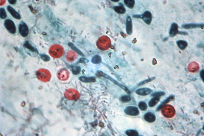 Oosquistes de Cryptosporidium sp. CDC Public Health Image Library (PHIL).