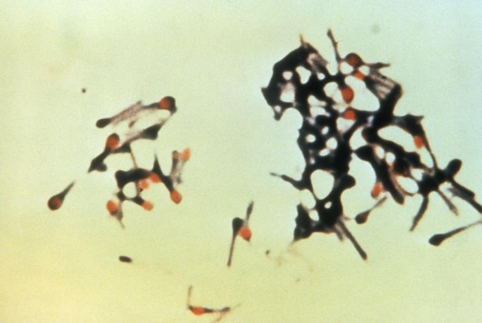 C. tetani. CDC Public Health Image Library (PHIL).