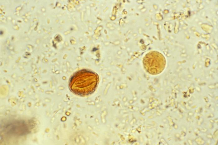 Quiste de E. histolytica. CDC Public Health Image Library.