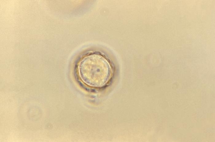 Quiste de A. polyphaga. CDC Public Health Image Library (PHIL).