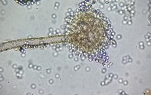 Aspergillus flavus (conidióforo y conidios) de Scot Nelson.