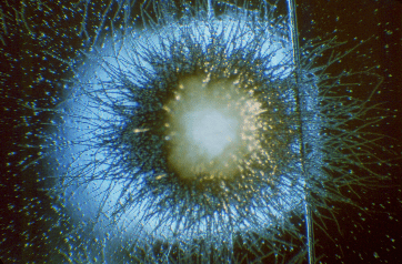 Colonia de Candida tropicalis. CDC Public Health Image Library (PHIL).