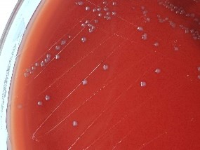 Colonias de Streptococcus suis de Joe Rubin