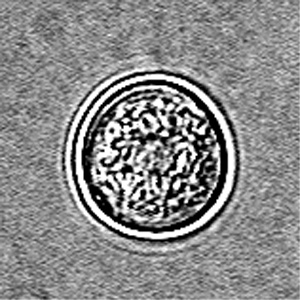 Quiste de Naegleria fowleri. DPDx - Laboratory Identification of Parasitic Diseases of Public Health Concern