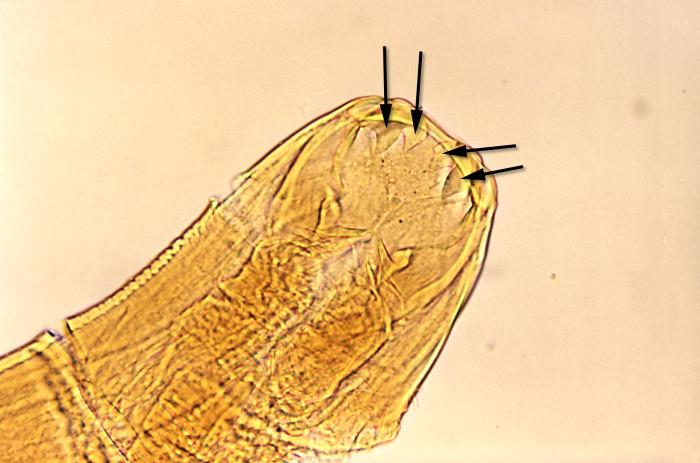 Boca de Ancylostoma duodenale. CDC Public Health Image Library (PHIL). 