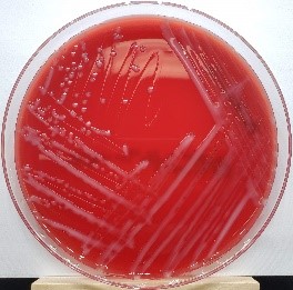 Pasteurella multocida