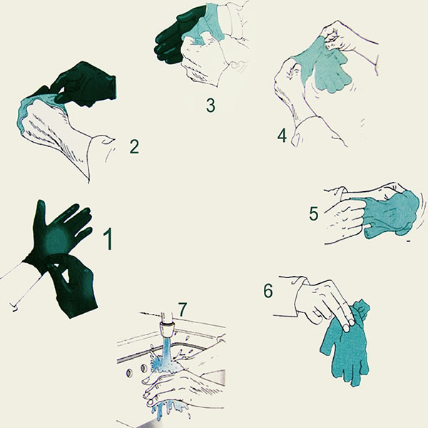 Aplicación del procedimiento para  la retirada de los guantes