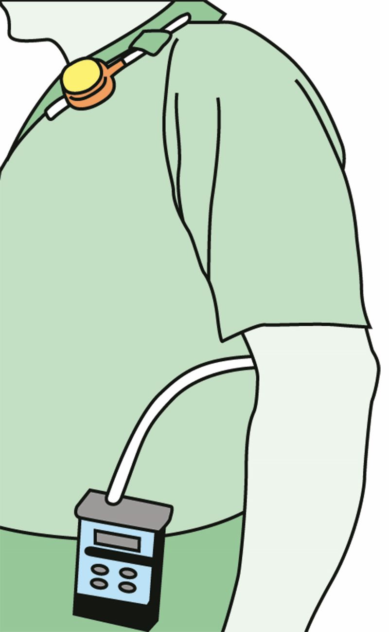 Figura 3