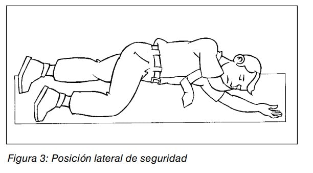Persona tumbada de lado en posición lateral de seguridad para primeros auxilios.