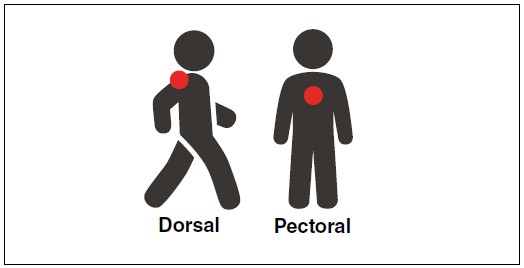 Pictogramas que señalan las posiciones de enganche dorsal y pectoral en un arnés